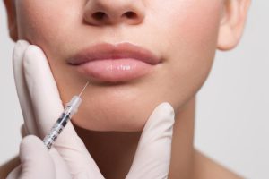 Hyaluronic Acid Lip Injection: Was it Worthwhile?